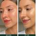 Sorted Skin 5 In 1 Anti-Redness Day Cream