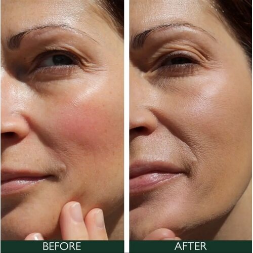 Sorted Skin 5 In 1 Anti-Redness Day Cream