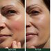 Sorted Skin 5 In 1 Anti-Redness Day Cream