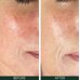 Sorted Skin 5 In 1 Anti-Redness Day Cream