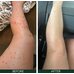 Sorted Skin Intensive Rescue Spray