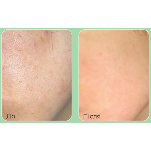 Medi-Peel Phyto Cica-Nol B5 3000 Shot Serum