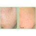Medi-Peel Phyto Cica-Nol B5 3000 Shot Serum