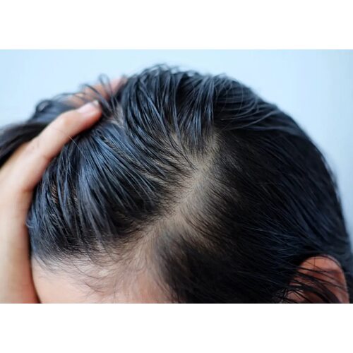 Derma Factory Deep Clean Fresh Scalp Scaler