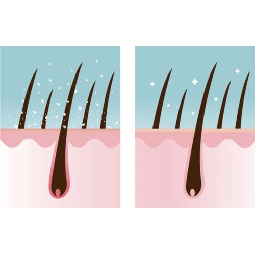 Derma Factory Deep Clean Fresh Scalp Scaler