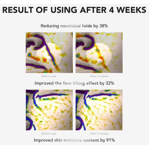 Skin&Lab Retinol Lifting Roller Cream