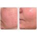Medi-Peel Phyto Exosome Pdrn Lifting Shot Serum