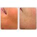 Medi-Peel Phyto Exosome Pdrn Lifting Shot Cream