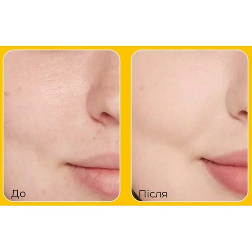 Medi-Peel Vitamin Collagen Brightening Mask