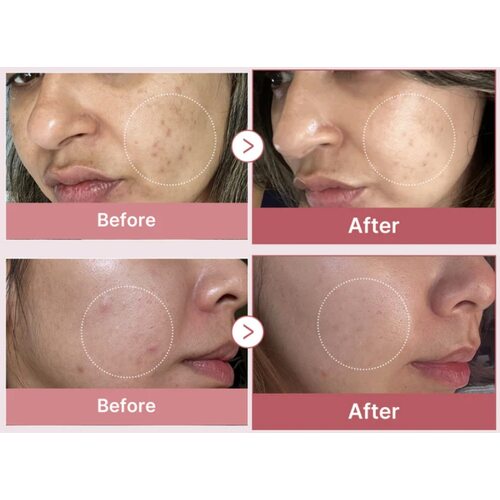 Medicube Pdrn Pink Peptide Serum