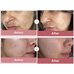 Medicube Pdrn Pink Peptide Serum