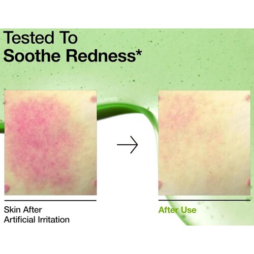 Anua Azelaic Acid 10 Hyaluron Redness Soothing Serum