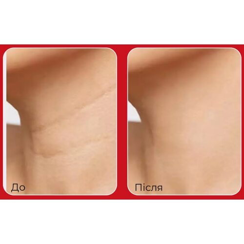 Medi-Peel Premium Naite Thread Neck Stick
