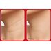 Medi-Peel Premium Naite Thread Neck Stick