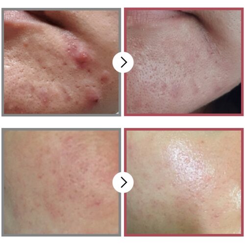 Numbuzin No.3 Skin Softening Serum