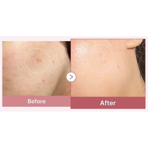 Medicube Pdrn Pink Hyaluronic Moisturizing Cream