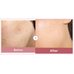Medicube Pdrn Pink Hyaluronic Moisturizing Cream