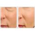 Medi-Peel Phyto Exosome PDRN Lifting Shot Eye Cream