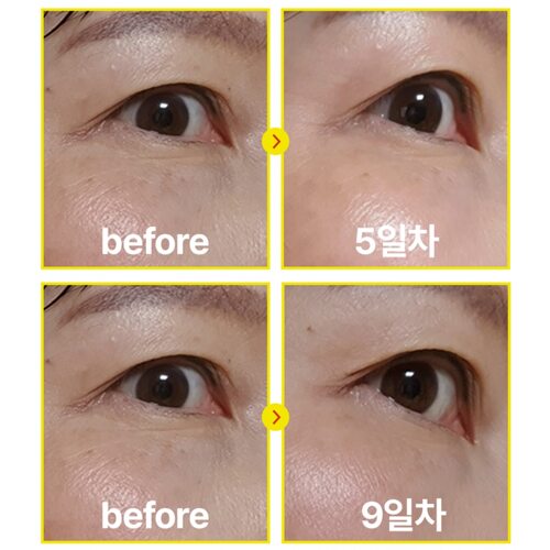 Be The Skin Vegan Retinal Bakuchiol Serum