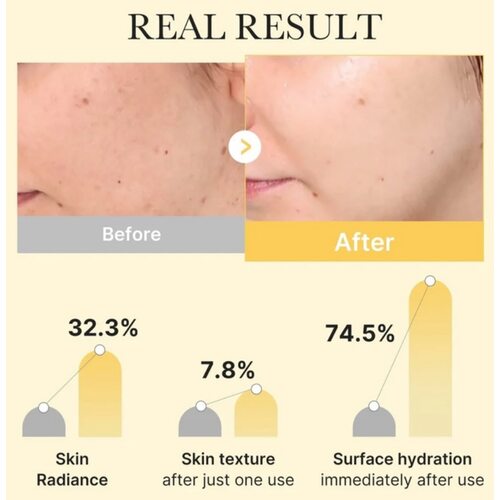 Medicube Kojic Acid Turmeric Brightening Gel Mask