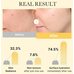 Medicube Kojic Acid Turmeric Brightening Gel Mask