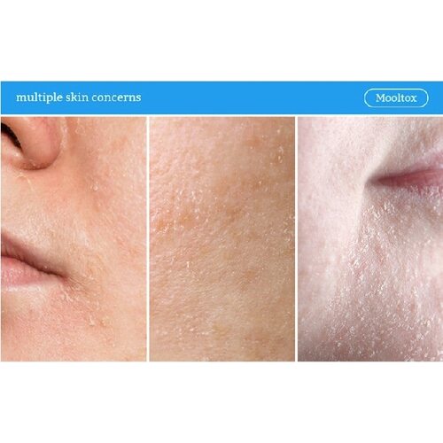 Medi-Peel Phyto Ex Pdrn Lifting Shot Drop Gel Cream