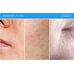 Medi-Peel Phyto Ex Pdrn Lifting Shot Drop Gel Cream