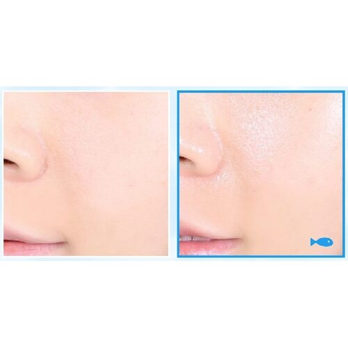 Medi-Peel Phyto Ex Pdrn Lifting Shot Drop Gel Cream