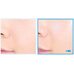 Medi-Peel Phyto Ex Pdrn Lifting Shot Drop Gel Cream