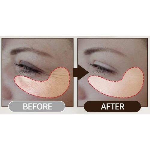 Acwell Licorice Ph Balancing Intensive Eye Cream