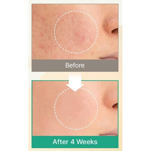 Acwell Licorice Ph Balancing Advance Serum