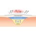 By Wishtrend Mandelic Acid Spot Clearing Patch