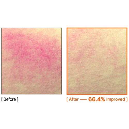 By Wishtrend Mandelic Acid Spot Clearing Patch