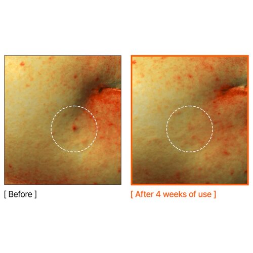By Wishtrend Mandelic Acid Spot Clearing Patch