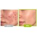 Purito Seoul Azelaic Acid 10 Kojic Tea Tree Serum