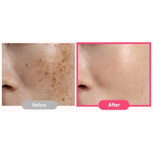 Purito Seoul Txa 6 Niacinamide 10 Retinal Serum