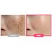 Purito Seoul Txa 6 Niacinamide 10 Retinal Serum