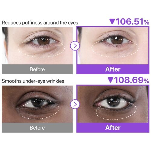 Numbuzin No.9 Nad Collagen Under Eye Patches
