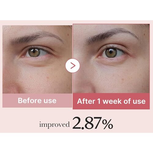 Medicube Pdrn Pink Peptide Eye Cream