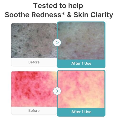 Medicube Azelaic Acid Niacinamide Deep Clean Foam Cleanser