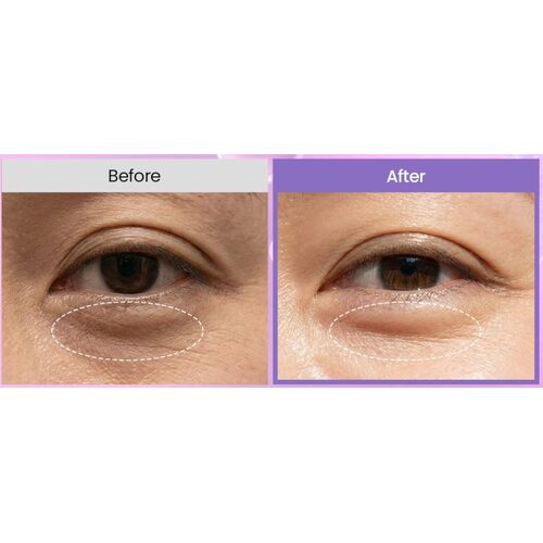 Biodance Caviar Pdrn Eye Patches