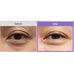 Biodance Caviar Pdrn Eye Patches