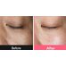 Abib Pdrn Retinal Eye Patch Glow Jelly