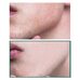 Some by mi AHA-BHA-PHA 30 Days Miracle Starter Kit