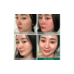Some by mi AHA-BHA-PHA 30 Days Miracle Starter Kit