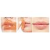 G9 Vita Ampoule Lip Patch