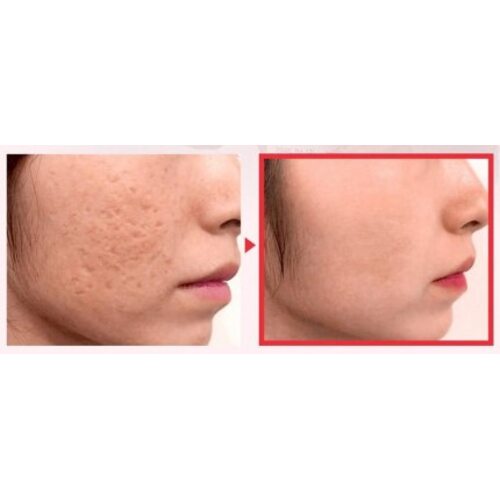 Some by mi Snail Truecica Miracle Repair Serum