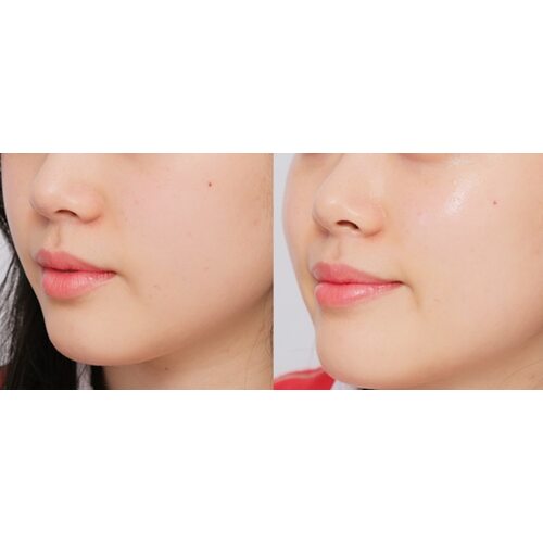Hyggee One Step Facial Essence Balance