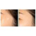 Some by mi CLEAR SPOT PATCH 18pcs