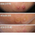 Some by mi CLEAR SPOT PATCH 18pcs